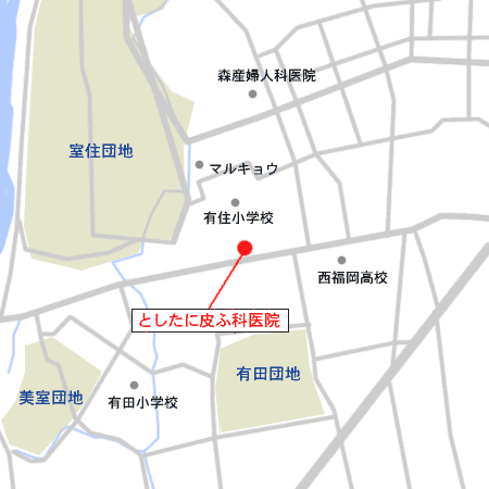 Lct
