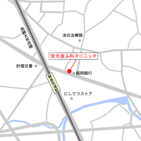 qǂwt