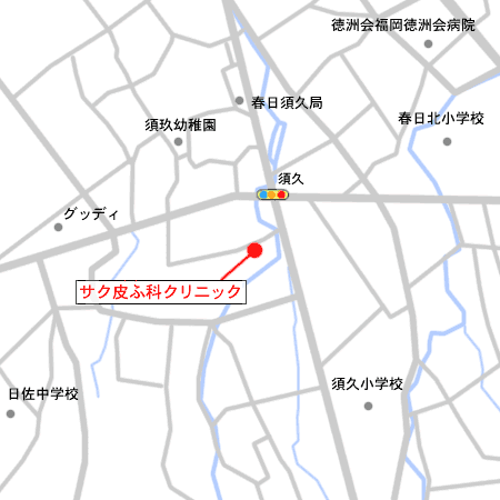 tst